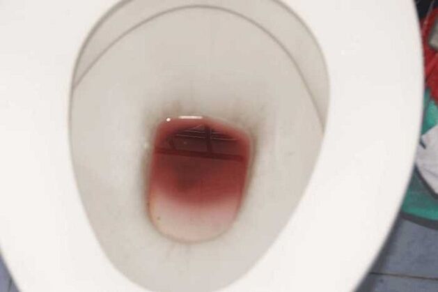 흥분할 때 남성에게서 발견됨